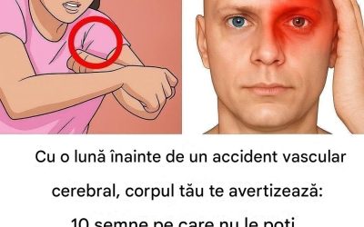 Corpul tău te avertizează cu o lună înainte de un accident vascular cerebral: 10 semne pe care nu ar trebui să le ignori