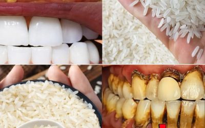 Teeth Whitening in Seconds? The Viral Rice Method Everyone’s Talking About – Truth, Risks, and What Really Works