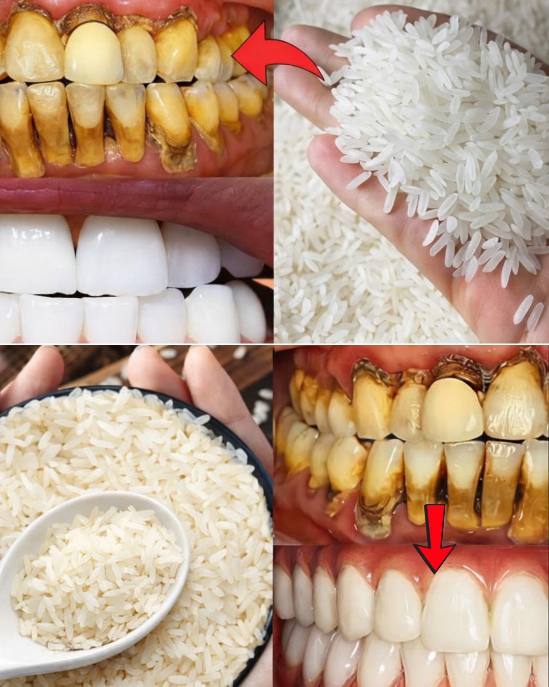 Teeth Whitening in Seconds? The Viral Rice Method Everyone’s Talking About – Truth, Risks, and What Really Works