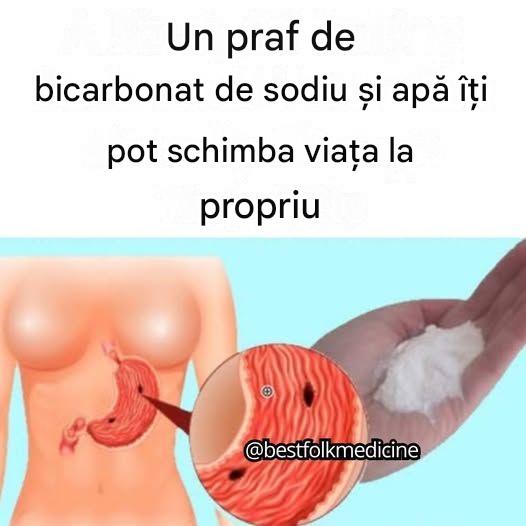 Bicarbonat de sodiu: Cel mai bun remediu natural pentru ameliorarea instantanee a arsurilor la stomac