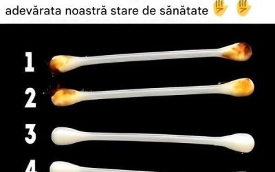 Urechile noastre dezvăluie adevărata noastră stare de sănătate