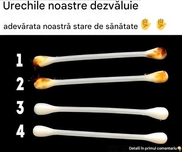 Urechile noastre dezvăluie adevărata noastră stare de sănătate