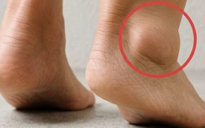 Picioare grele și glezne umflate: Ce dezvăluie aceste umflături și cum pot fi remediate?