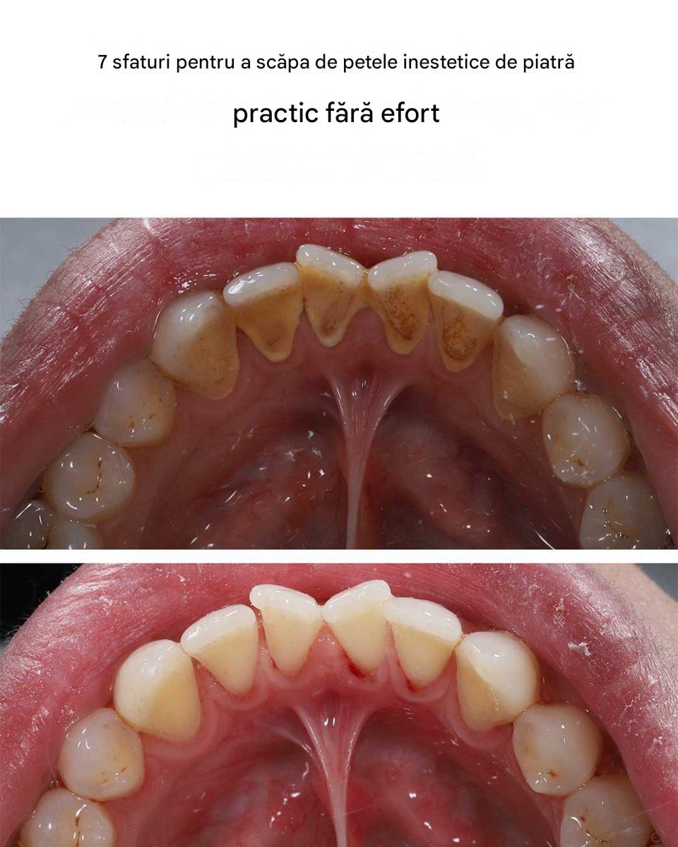 7 sfaturi pentru a scăpa de petele inestetice de piatră practic fără efort