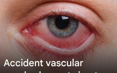 Accident vascular cerebral al ochiului: acest simptom poate duce la pierderea vederii în câteva ore