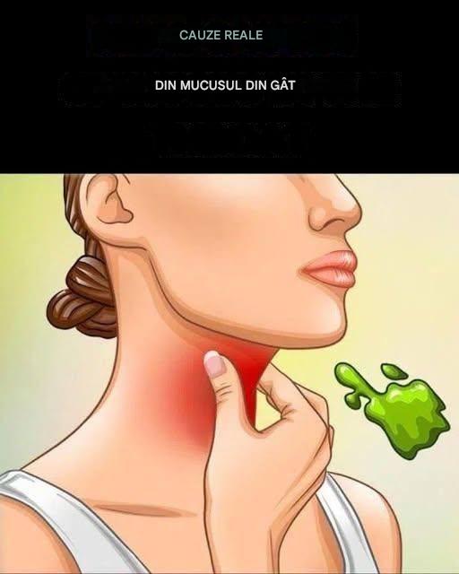 Cauzele reale ale mucusului în gât și cum să scapi de el
