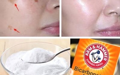 Cum să folosești bicarbonatul de sodiu pentru a elimina petele, ridurile și cearcănele de pe față 😍