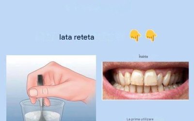 Îndepărtează tartrul și albește-ți dinții cu această rețetă simplă. Link la rețetă în comentarii 👇👇👇