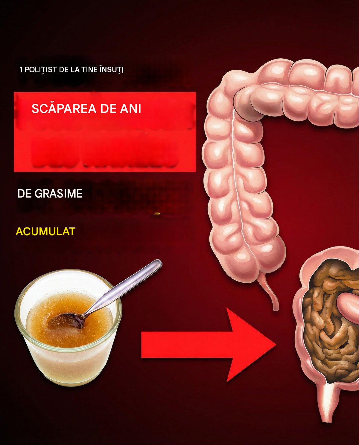 Bea asta în fiecare dimineață pentru a scăpa de grăsimile toxice stocate ani de zile!