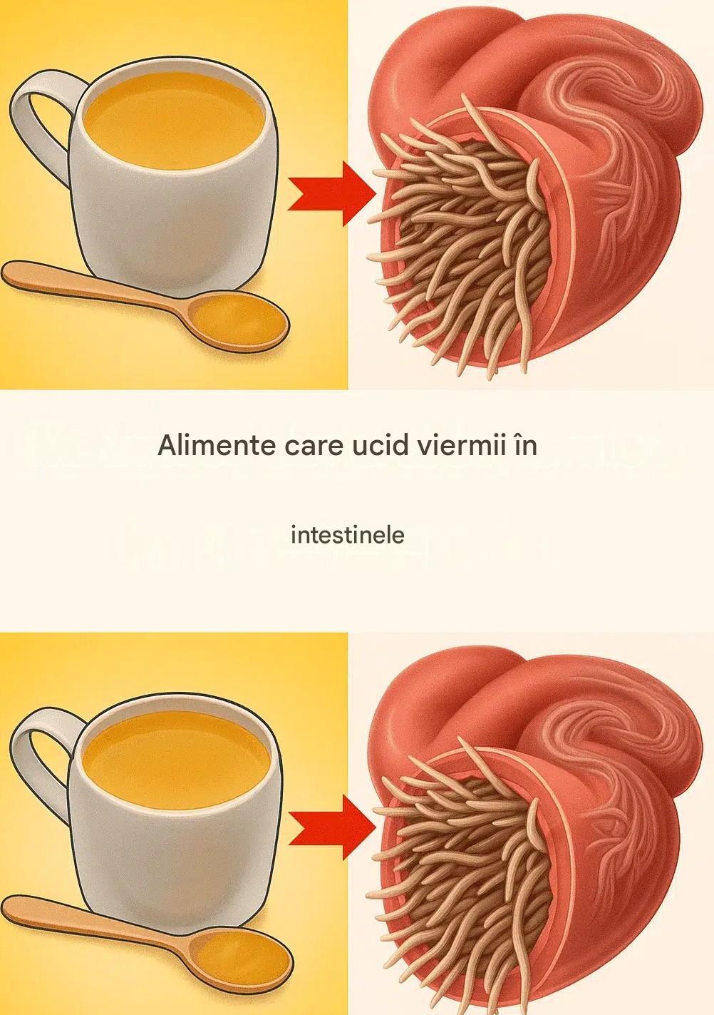 7 alimente care ucid viermii intestinali