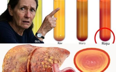 Ce spune cu adevărat culoarea urinei despre sănătatea ta (este mai interesant decât crezi)