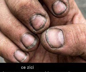 Cum se numește o persoană cu astfel de unghii?