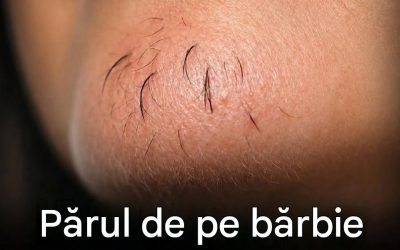 Părul de pe bărbie al femeilor: ce încearcă corpul tău să-ți transmită