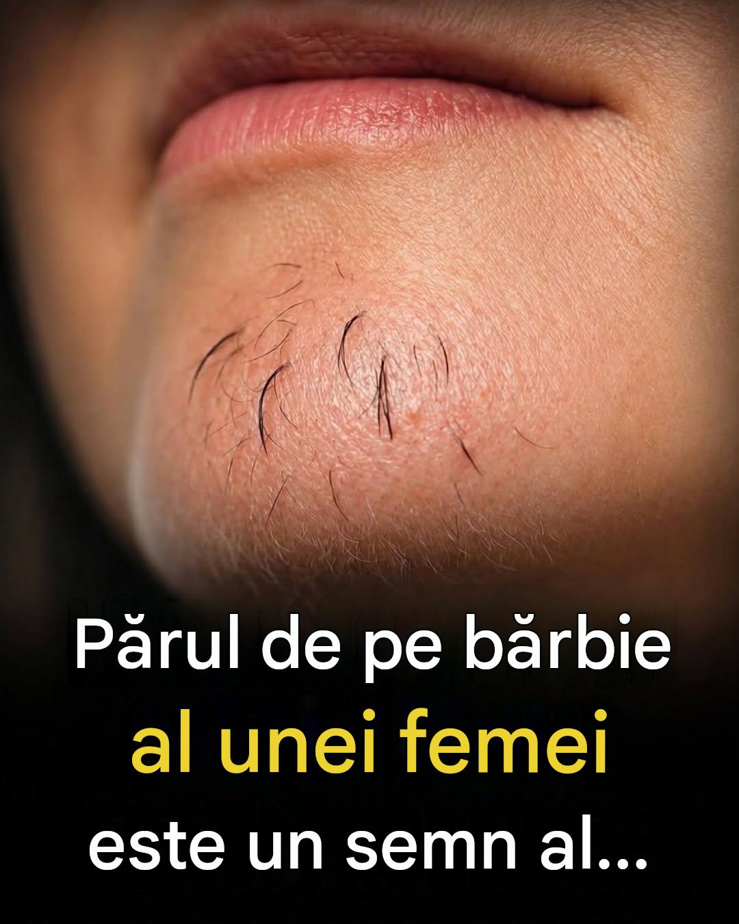 Părul de pe bărbie al femeilor: ce încearcă corpul tău să-ți transmită