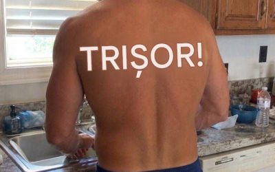 Soțul meu s-a întors acasă dintr-o “călătorie de afaceri” cu “ÎNȘELĂTOR!” Arsuri de soare pe spate – am folosit asta în avantajul meu